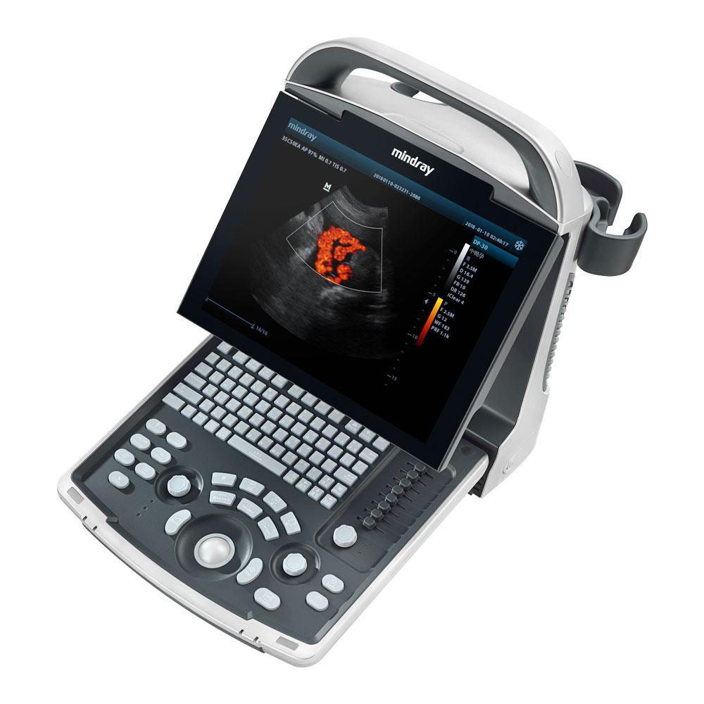 1 mindray dp 30 ultrasound machine2